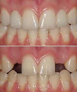 The Question Of Missing Teeth